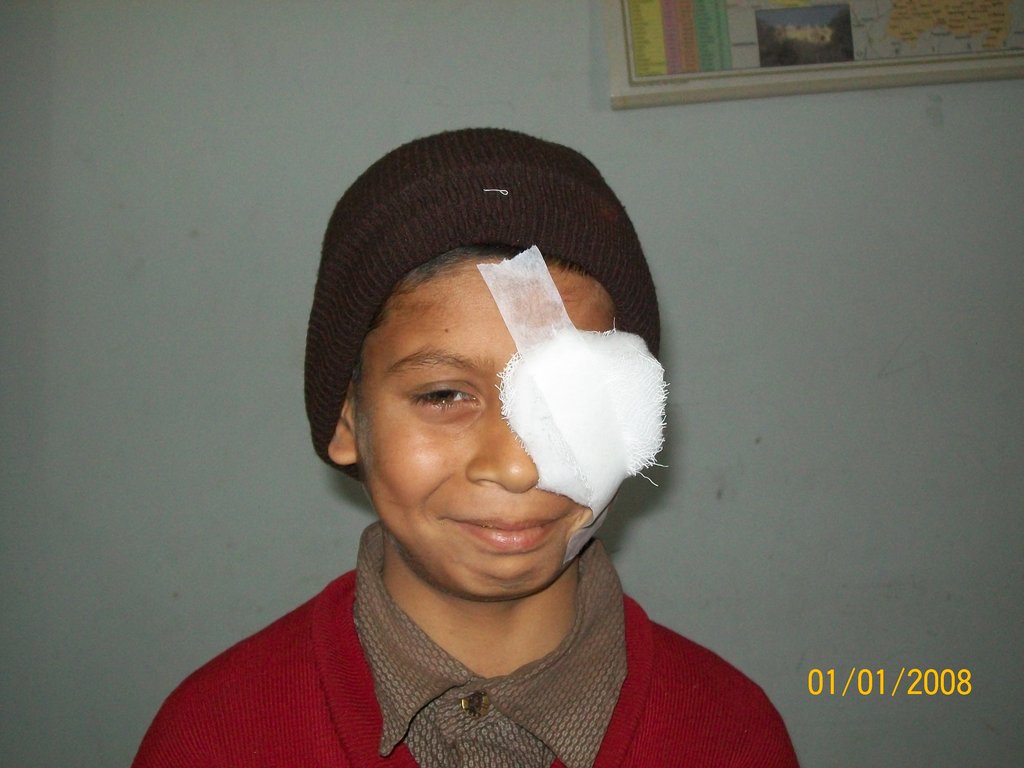 Restore eyesight to 2000 villagers in India