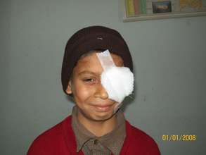 Child operated for low vision