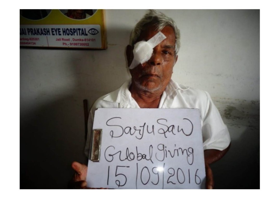 After Cataract Surgery