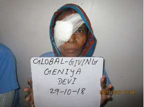 Geniya after surgery