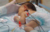 Free Heart Surgeries for Rio's Poor Children