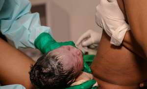 Nepali woman and baby at birth