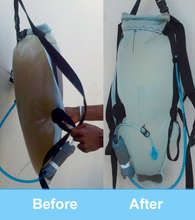 DayOne Waterbag, Before and After Treatment