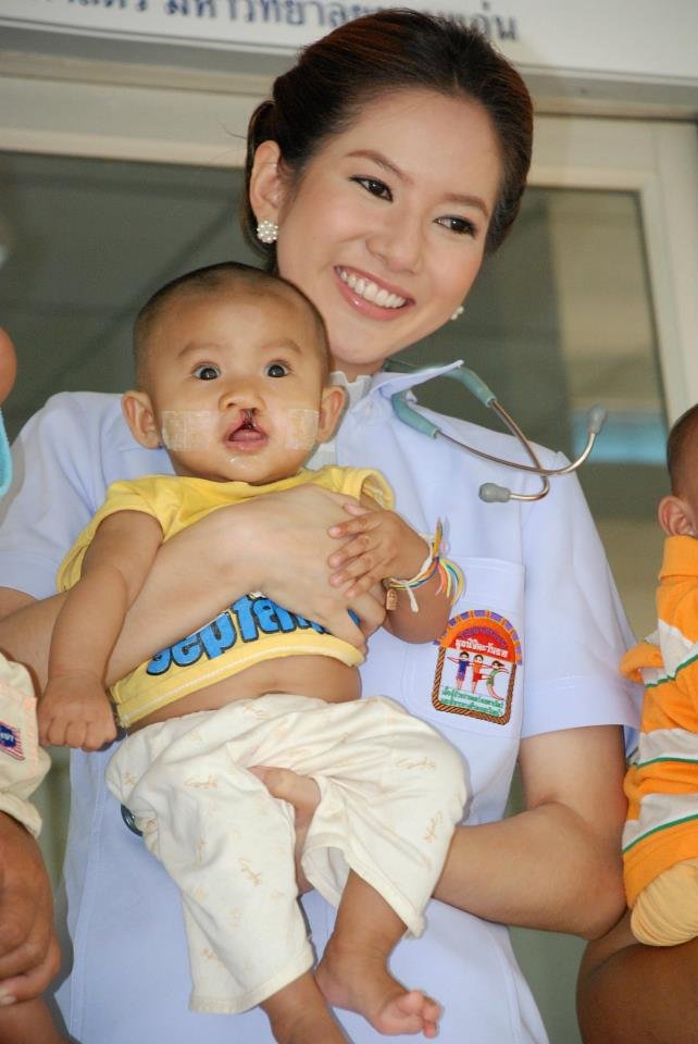 Student-led cleft surgery for 10 rural children