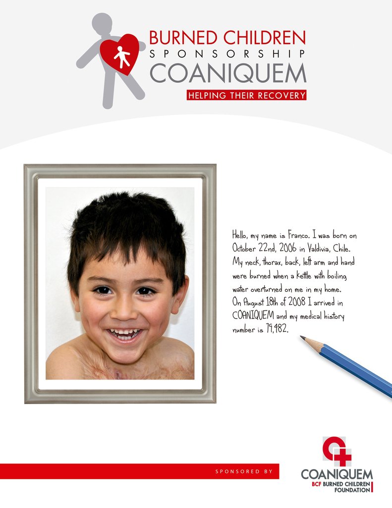 Sponsor the Care of a Latin American Burned Child