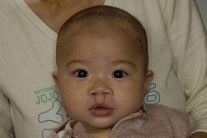 Baojing Lai, Age 1, Before