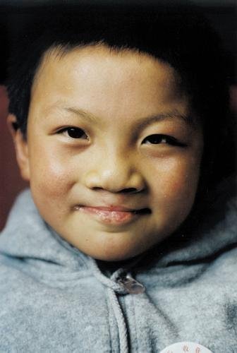Free Cleft Surgery for 600 Poor Chinese Children