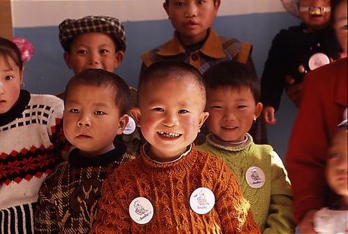 Free Cleft Surgery for 600 Poor Chinese Children