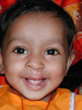 Anu, age 2, after