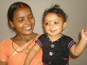 Baby, G.S. Memorial's 20,000th Smile Train Patient
