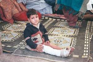Injured child
