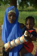 Niger, 2010 Yann Libessart/MSF