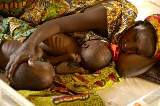 Treating Global Childhood Malnutrition