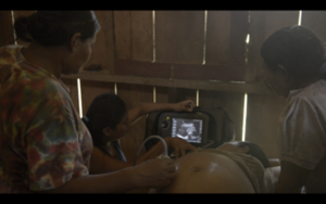 A partera using the ultrasound on a pregnant women