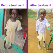 Josephine in Liberia