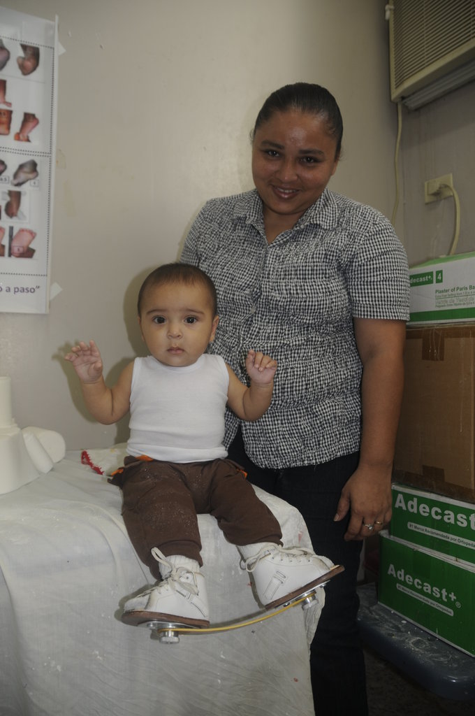 Support Clubfoot Treatment for 270 Children
