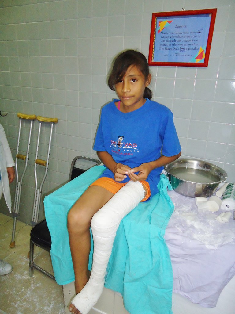 Support Clubfoot Treatment for 270 Children
