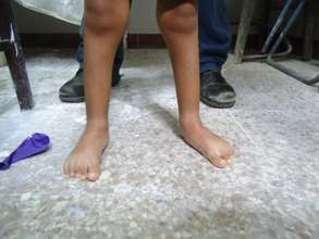 Wilder after treatment