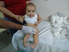 Silvio before treatment.