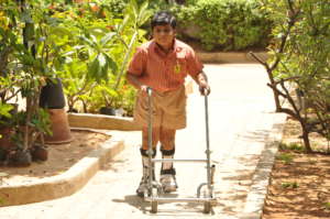 SIS Student walking knee surgery for both legs