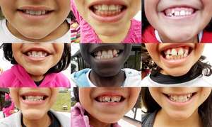 Say "Cheese"!