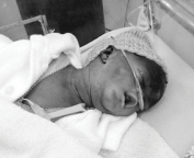 Baby Wilnese grows strong in our neonatal unit