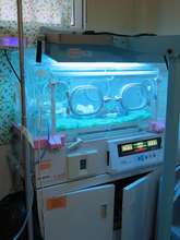 A baby having life saving phototherapy