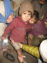 Wounded child