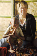 Inle Lake Child with Softbone Disease