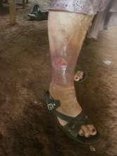 Primativa's leg is healed & she's now back at work