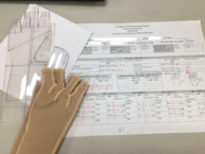 Sample of pressure garment glove