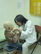 Helping a little burn survivor from Sao Tome