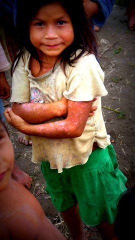 Justice After 40 years of Oil Contamination!
