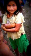 Child with Skin Problems