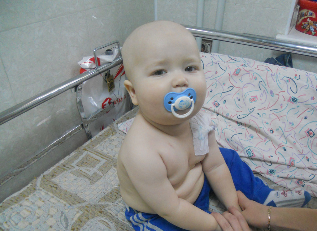 Surgeries and Medical Care for Moldovan Children