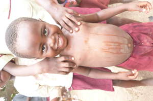 Effects of poor water quality for children