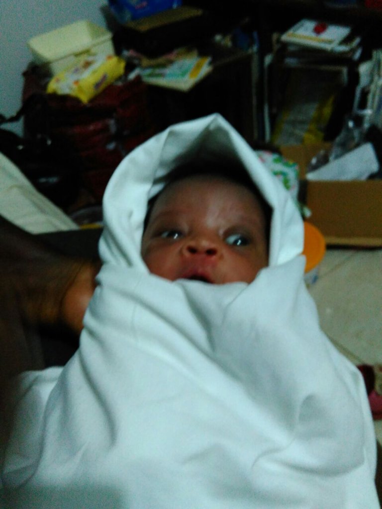 The child at 5 days old