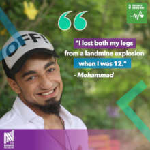 Mohammad, on the loss of his legs.