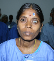 Santhi Before Surgery