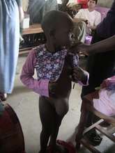 Little Girl with a hernia