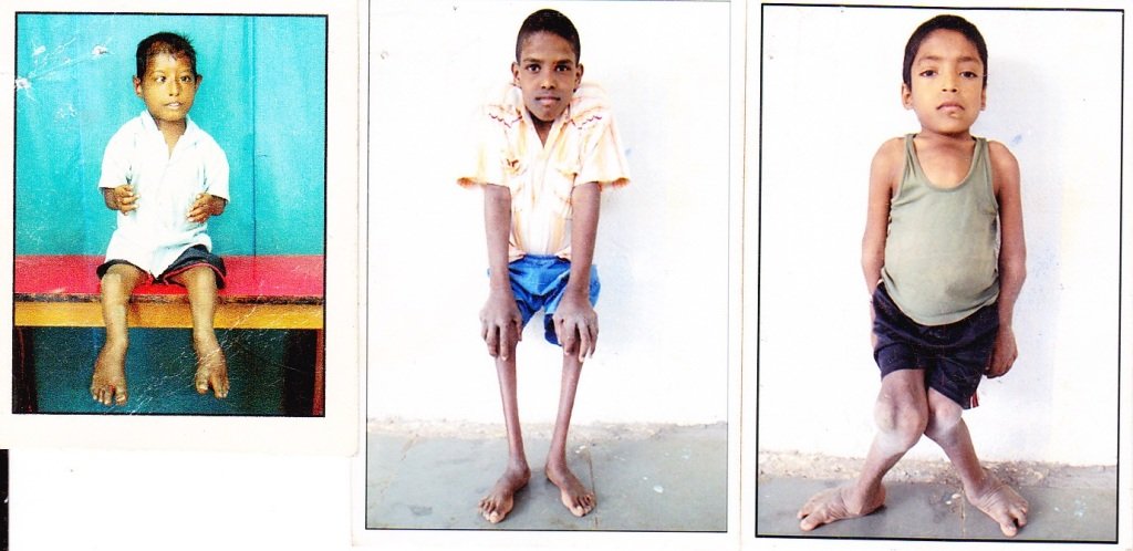 support-poor-needy-handicapped-orphans-indian