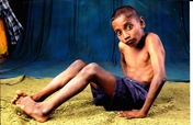 support-poor-needy-handicapped-orphans-indian