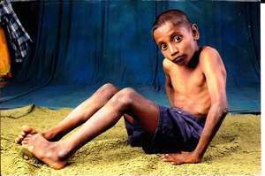 support-poor-needy-handicapped-orphans-indian