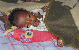 Babies in Darfur are severely malnourished