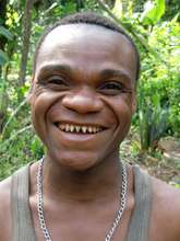 Albert after his hernia operation