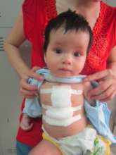 Tuyet has also received surgery in 2016