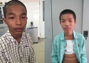 Duc: before and after. Looking much healthier!