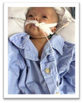 Little Tu is resting and awake after his surgery.