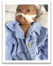 Little Tu is resting and awake after his surgery.