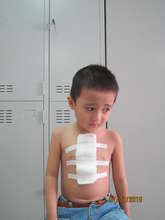 Hung post-surgery, a little nervous